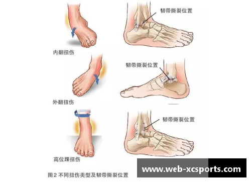 篮网大腿踝关节伤势恢复缓慢，球队面临内外线双重打击